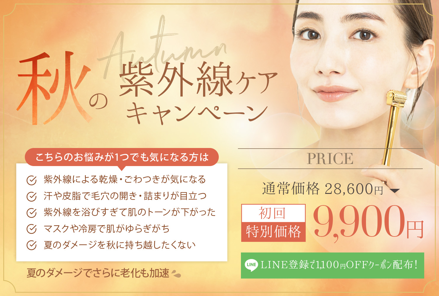 キャンペーン